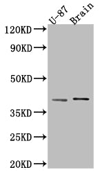 NGF Antibody