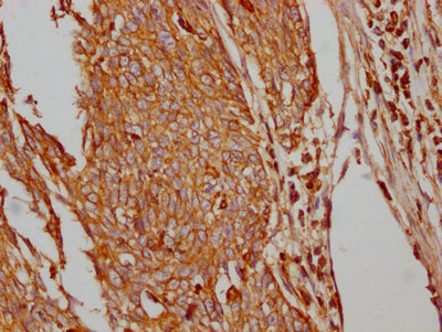 SLC2A1 Antibody