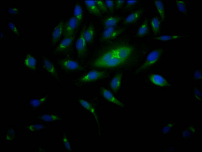 RPS6KB1 Antibody