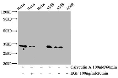 Phospho-CDK1/CDK2/CDK3 (T14) Antibody