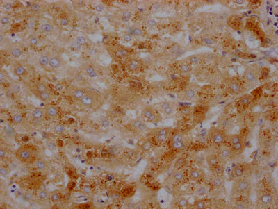 TTR Antibody