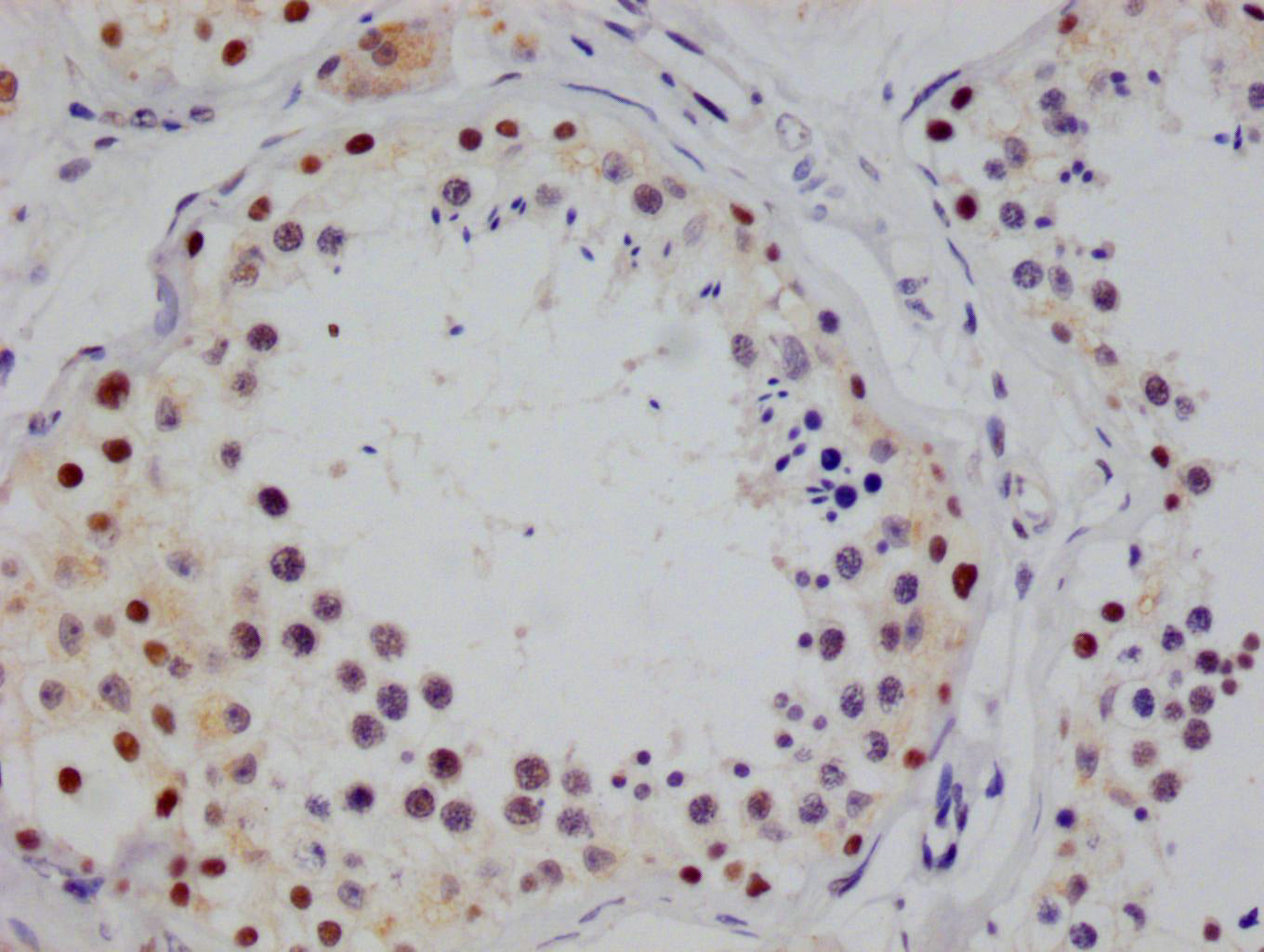 STAT4 Antibody