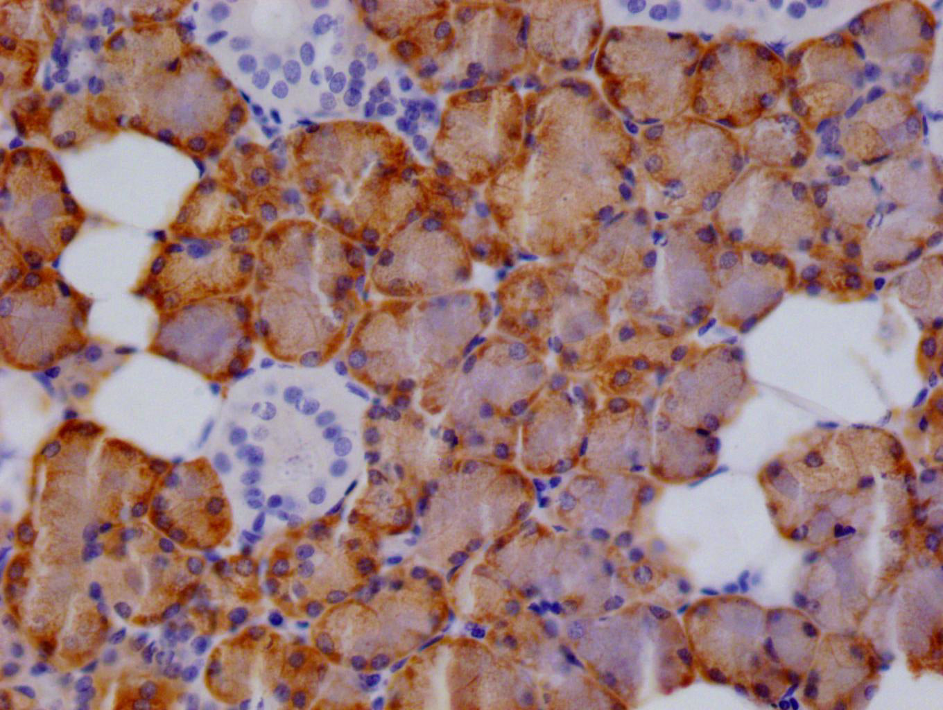 CTPS1 Antibody