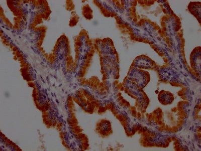 KLK3 Antibody