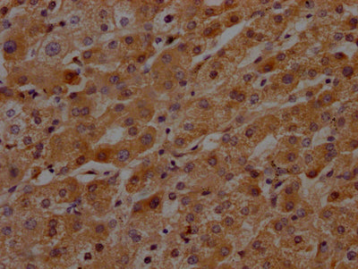 KLKB1 Antibody