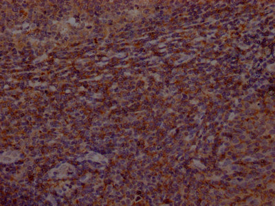 BTK Antibody
