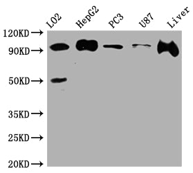 PDCD6IP Antibody