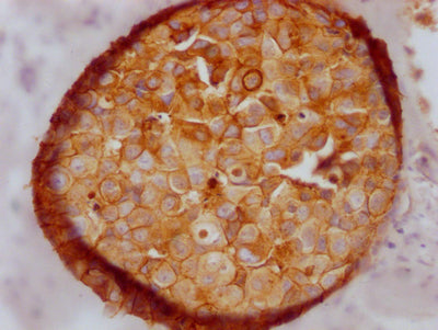 CDH1 Antibody