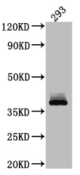 DKK1 Antibody