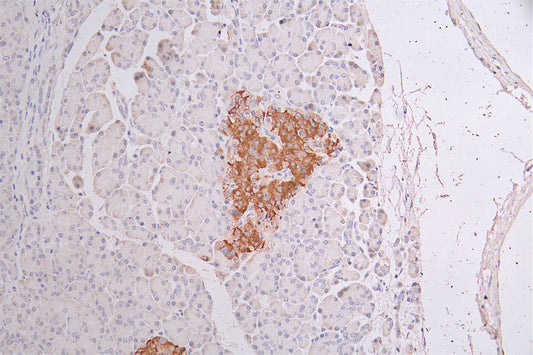 KRT10 Recombinant Monoclonal Antibody