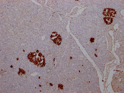 INS Antibody