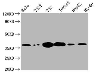 TYMS Antibody