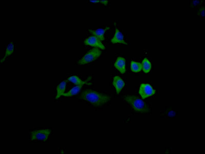 TP53 Antibody