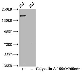 Phospho-SMC1A (S957) Antibody