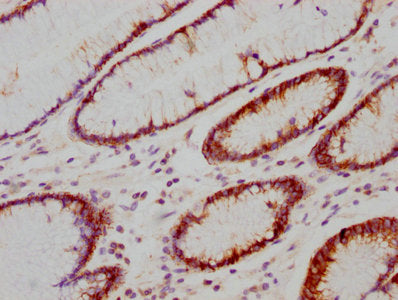 CA9 Antibody