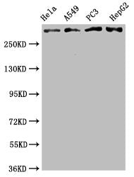 ATM Antibody