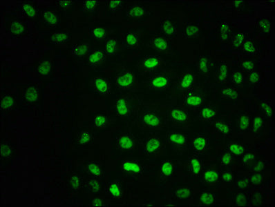 Phospho-ATM (S1981) Antibody
