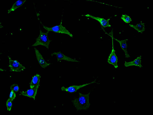 NTRK2 Recombinant Monoclonal Antibody