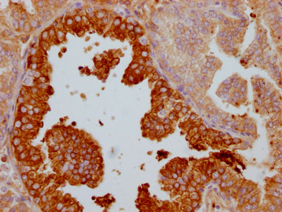 LTF Antibody