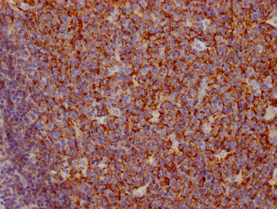 CR1 Antibody