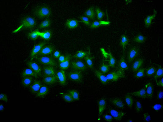 ILDR2 Recombinant Monoclonal Antibody