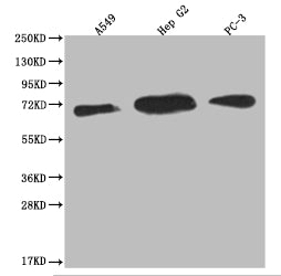 USP22 Antibody