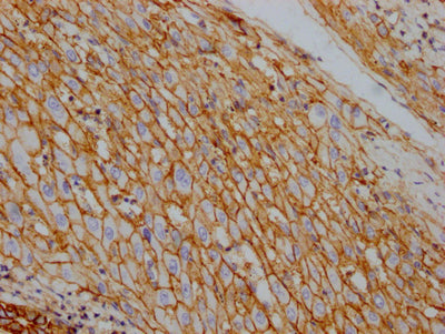 ATP1A1 Antibody