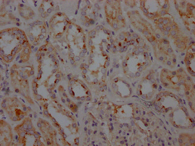 LRRK2 Antibody