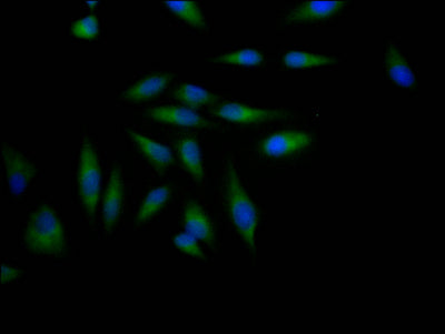 ADAM17 Antibody