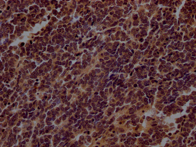 TERT Antibody