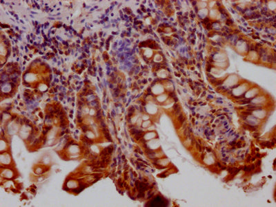 HTT Antibody