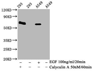 Phospho-PRKAA2 (Thr172) Antibody