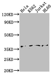 TBP Antibody