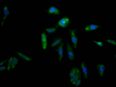 AKR1C3 Antibody