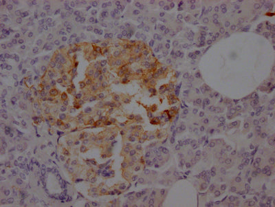 SSTR2 Antibody
