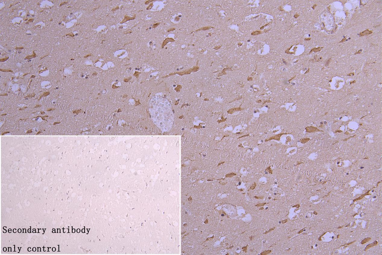 CHRM3 Antibody