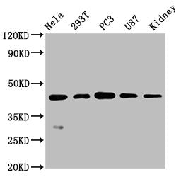 NDRG1 Antibody