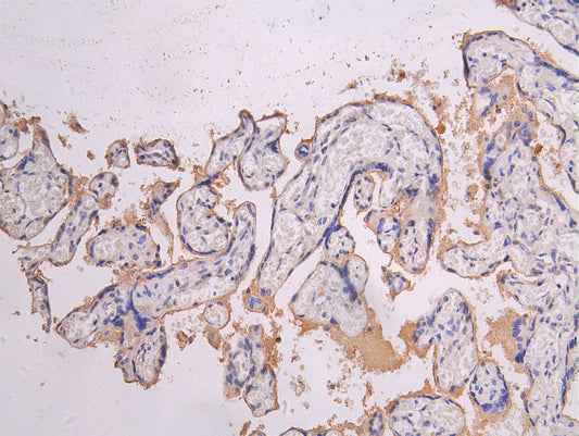 HTRA1 Recombinant Monoclonal Antibody
