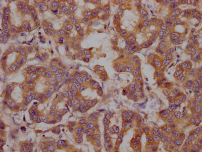 HSPA5 Antibody