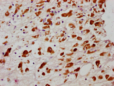 Phospho-MLKL (S358) Antibody