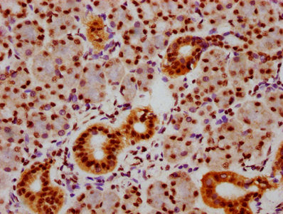 Phospho-SMAD5 (S463+S465) Antibody