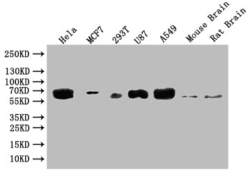 GBA Antibody