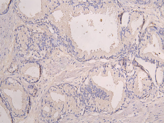 SIGLEC8 Recombinant Monoclonal Antibody