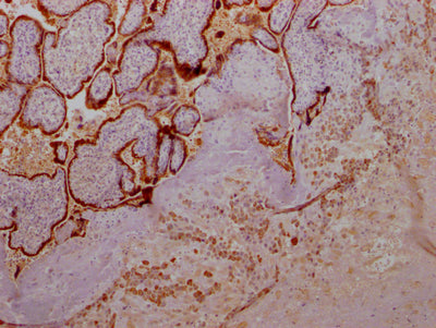 GH1 Antibody