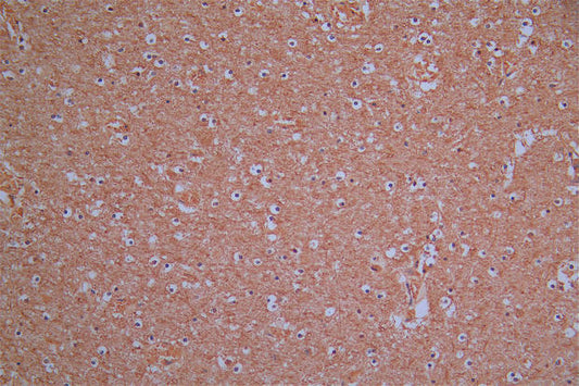 ROBO1 Recombinant Monoclonal Antibody