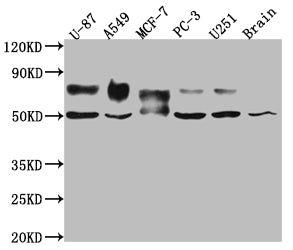 TPBG Antibody