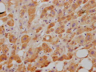 NPC1L1 Antibody