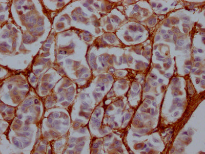 FN1 Antibody