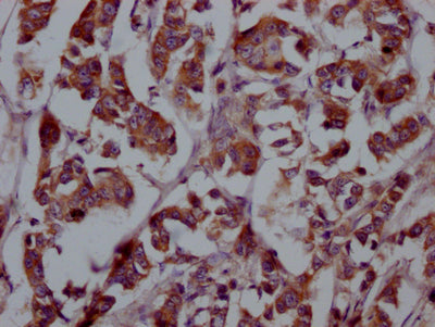 FGFR4 Antibody