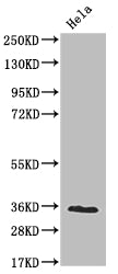 NUDT5 Antibody
